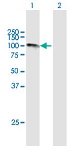 CAST Antibody in Western Blot (WB)