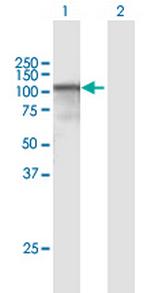 CAST Antibody in Western Blot (WB)