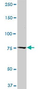 CAST Antibody in Western Blot (WB)