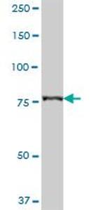 CARS Antibody in Western Blot (WB)