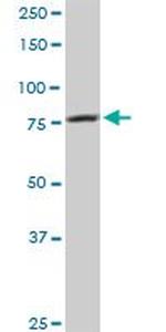 CARS Antibody in Western Blot (WB)