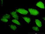 CASP3 Antibody in Immunocytochemistry (ICC/IF)