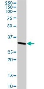 CASP3 Antibody in Western Blot (WB)