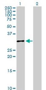 CASP3 Antibody in Western Blot (WB)