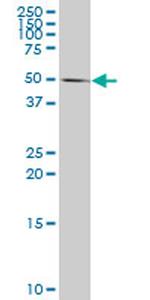 CASP10 Antibody in Western Blot (WB)