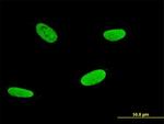 RUNX2 Antibody in Immunocytochemistry (ICC/IF)