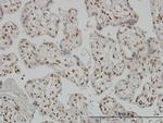 RUNX2 Antibody in Immunohistochemistry (Paraffin) (IHC (P))