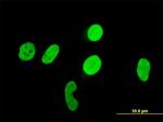 RUNX1 Antibody in Immunocytochemistry (ICC/IF)