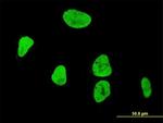 RUNX1 Antibody in Immunocytochemistry (ICC/IF)