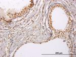 RUNX1 Antibody in Immunohistochemistry (Paraffin) (IHC (P))