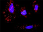 RUNX1 Antibody in Proximity Ligation Assay (PLA) (PLA)