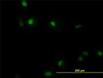 RUNX1 Antibody in Immunocytochemistry (ICC/IF)