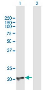 CBFB Antibody in Western Blot (WB)