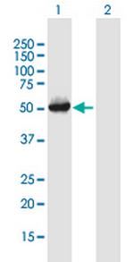 SERPINH1 Antibody in Western Blot (WB)