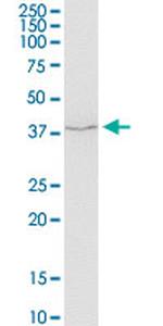 SERPINH1 Antibody in Western Blot (WB)