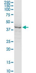 SERPINH1 Antibody in Western Blot (WB)