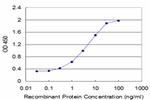 CBS Antibody in ELISA (ELISA)