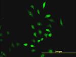 CBS Antibody in Immunocytochemistry (ICC/IF)