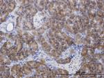 CBS Antibody in Immunohistochemistry (Paraffin) (IHC (P))