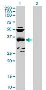 CCBL1 Antibody in Western Blot (WB)