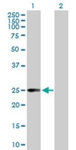 CCBL1 Antibody in Western Blot (WB)