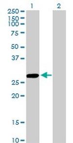 CCBL1 Antibody in Western Blot (WB)