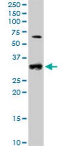 CCND2 Antibody in Western Blot (WB)