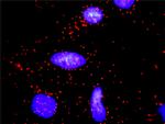 CCND2 Antibody in Proximity Ligation Assay (PLA) (PLA)