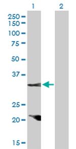 CCND2 Antibody in Western Blot (WB)