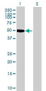 CCNE1 Antibody in Western Blot (WB)