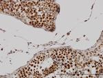 CCNH Antibody in Immunohistochemistry (Paraffin) (IHC (P))