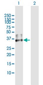 CD1D Antibody in Western Blot (WB)