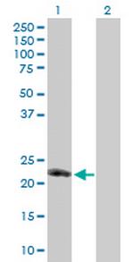 TNFSF8 Antibody in Western Blot (WB)