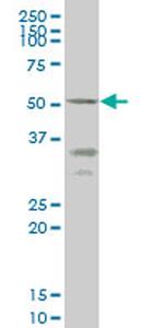 ENTPD5 Antibody in Western Blot (WB)