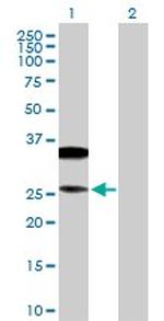 CD79B Antibody in Western Blot (WB)