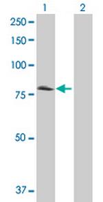 CD97 Antibody in Western Blot (WB)