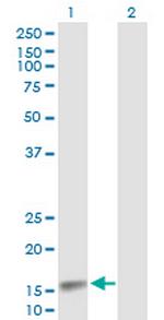 CDA Antibody in Western Blot (WB)