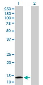 CDA Antibody in Western Blot (WB)