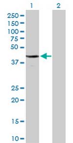 CDC2 Antibody in Western Blot (WB)