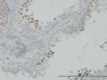 CDC2 Antibody in Immunohistochemistry (Paraffin) (IHC (P))