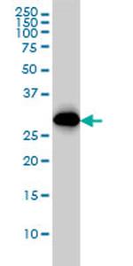 CDC2 Antibody in Western Blot (WB)