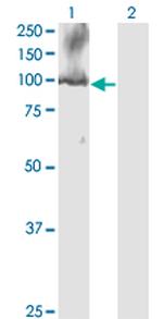 CDC5L Antibody in Western Blot (WB)