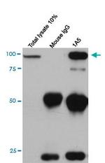 CDH11 Antibody in Immunoprecipitation (IP)