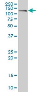 CDH17 Antibody in Western Blot (WB)