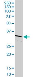 CDK2 Antibody in Western Blot (WB)