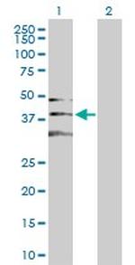 CDK2 Antibody in Western Blot (WB)