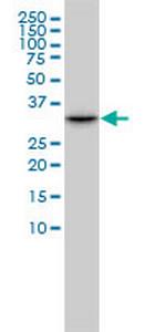 CDK2 Antibody in Western Blot (WB)