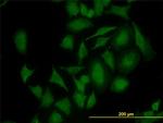 CDK4 Antibody in Immunocytochemistry (ICC/IF)