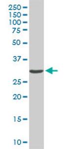 CDK4 Antibody in Western Blot (WB)