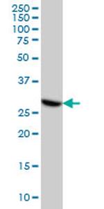 CDK4 Antibody in Western Blot (WB)